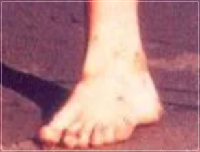 マリリンモンローの足の指